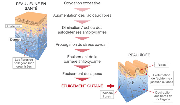 Oxidative stress