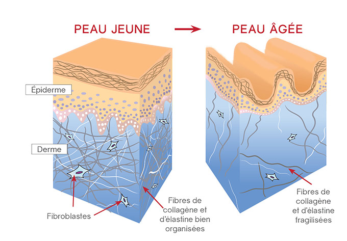 Peau âgée