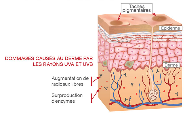 Dommages causés au dermis par les rayons UVA et UVB
